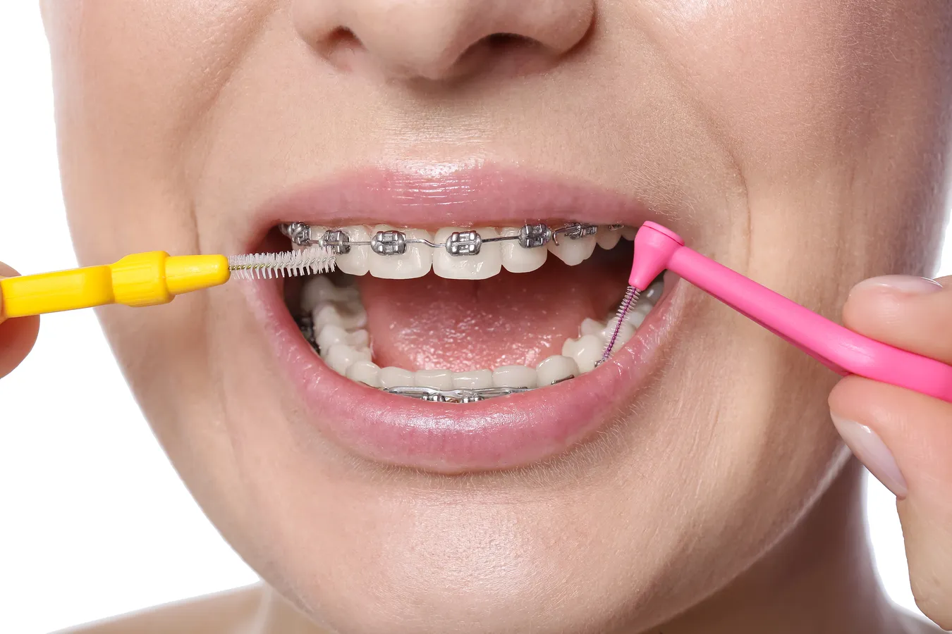 jak-pozyskac-pacjentow-do-gabinetu-stomatologicznego-1