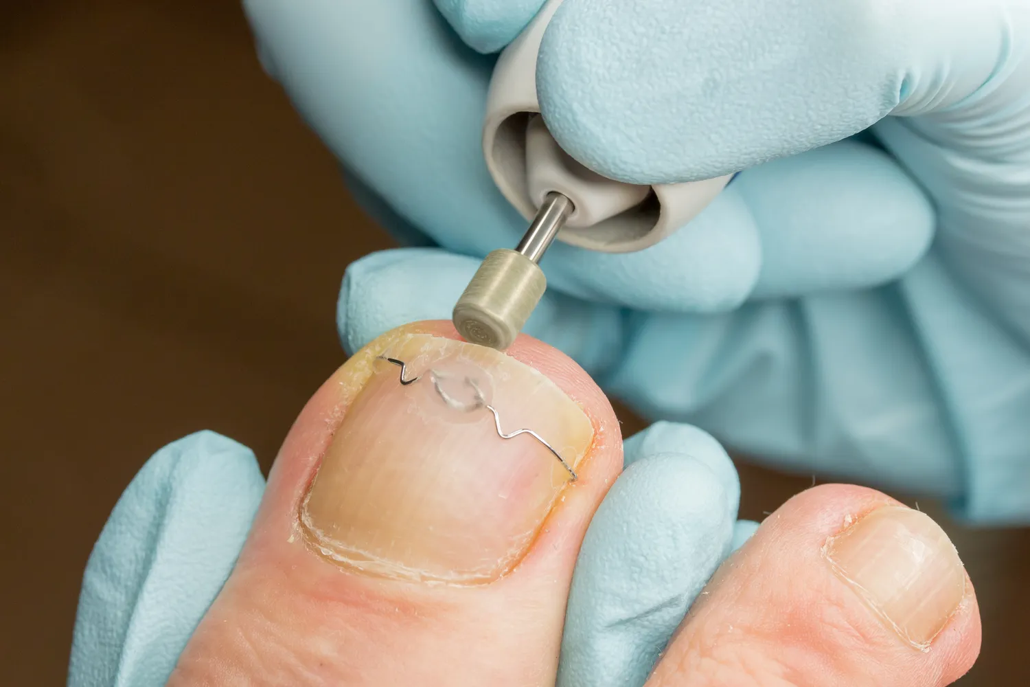 Podologia co to znaczy?