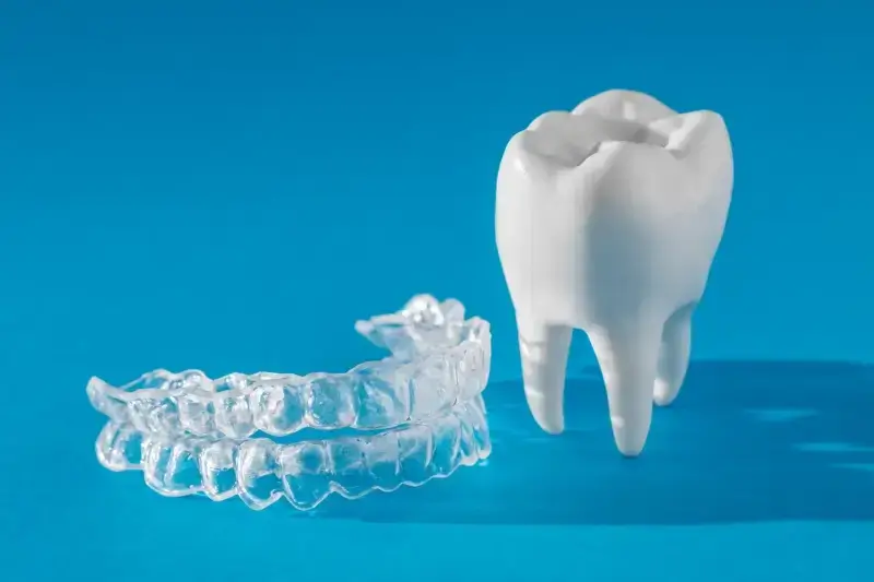 Jak długo trwa leczenie Invisalign?