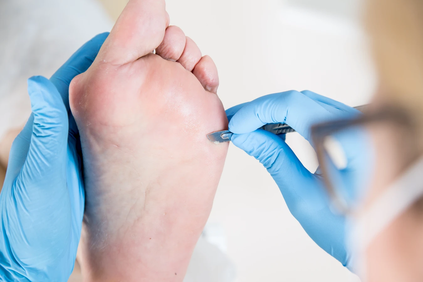 pedicure-leczniczy-warszawa-1