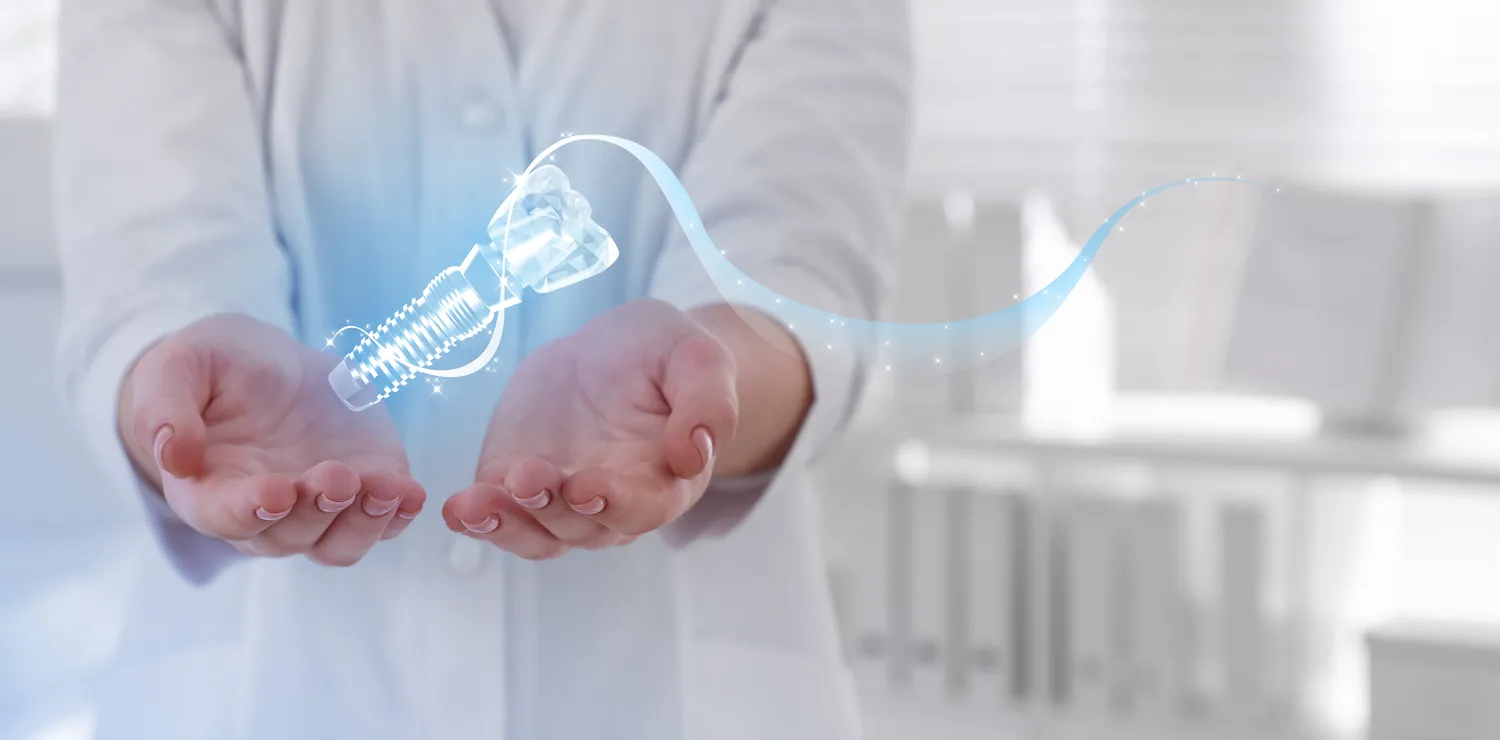 Implanty zębów - czy mogą nam zastąpić prawdziwe zęby?