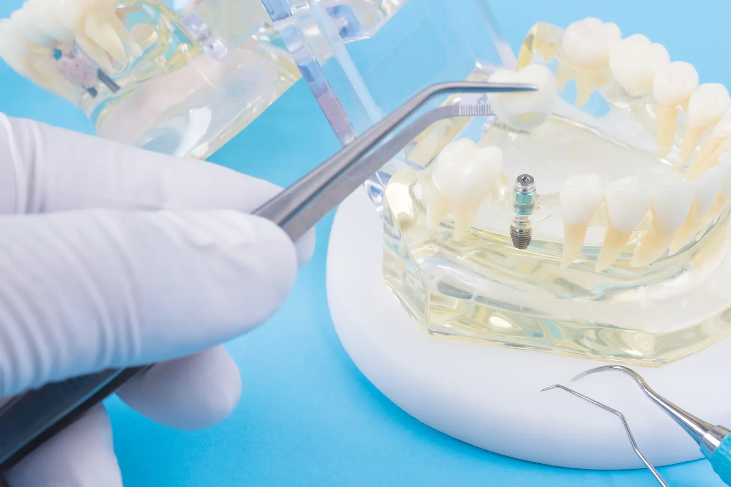 powszechne-zabiegi-w-stomatologii-1