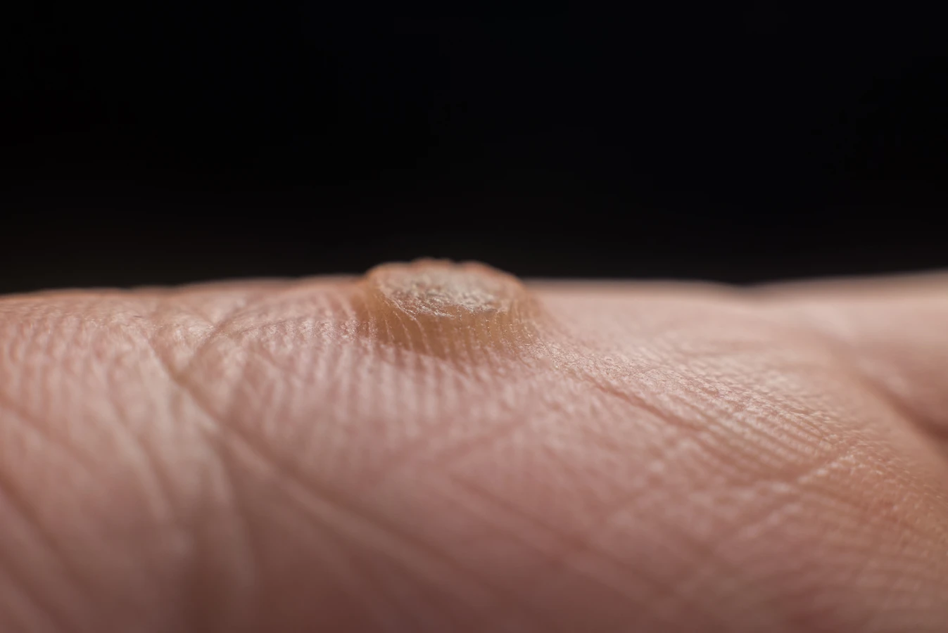 podologia-pomoc-dla-stop-f